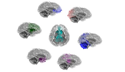 Chimpancés y humanos comparten cerebros adaptables con patrones evolutivos similares